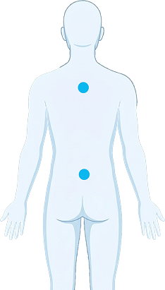 Back anatomical body illustration used in the MediCheck interactive body map